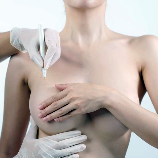 Meme Onarımı - Prof. Dr. Cüneyt Özek