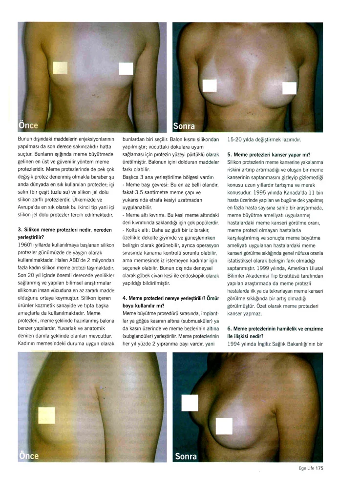 Ege Life - Prof. Dr. Cüneyt Özek