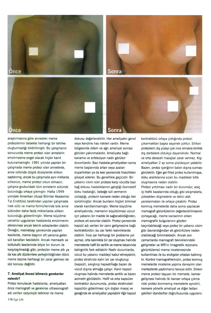 Ege Life - Prof. Dr. Cüneyt Özek