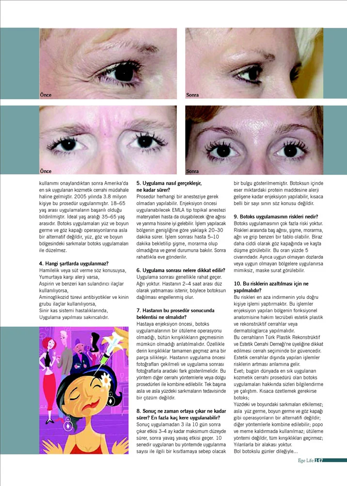 Ege Life - Prof. Dr. Cüneyt Özek